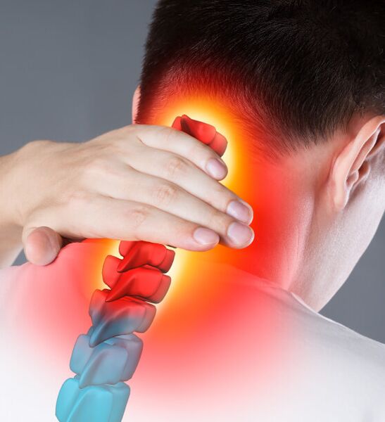 Symptoms of cervical osteochondrosis